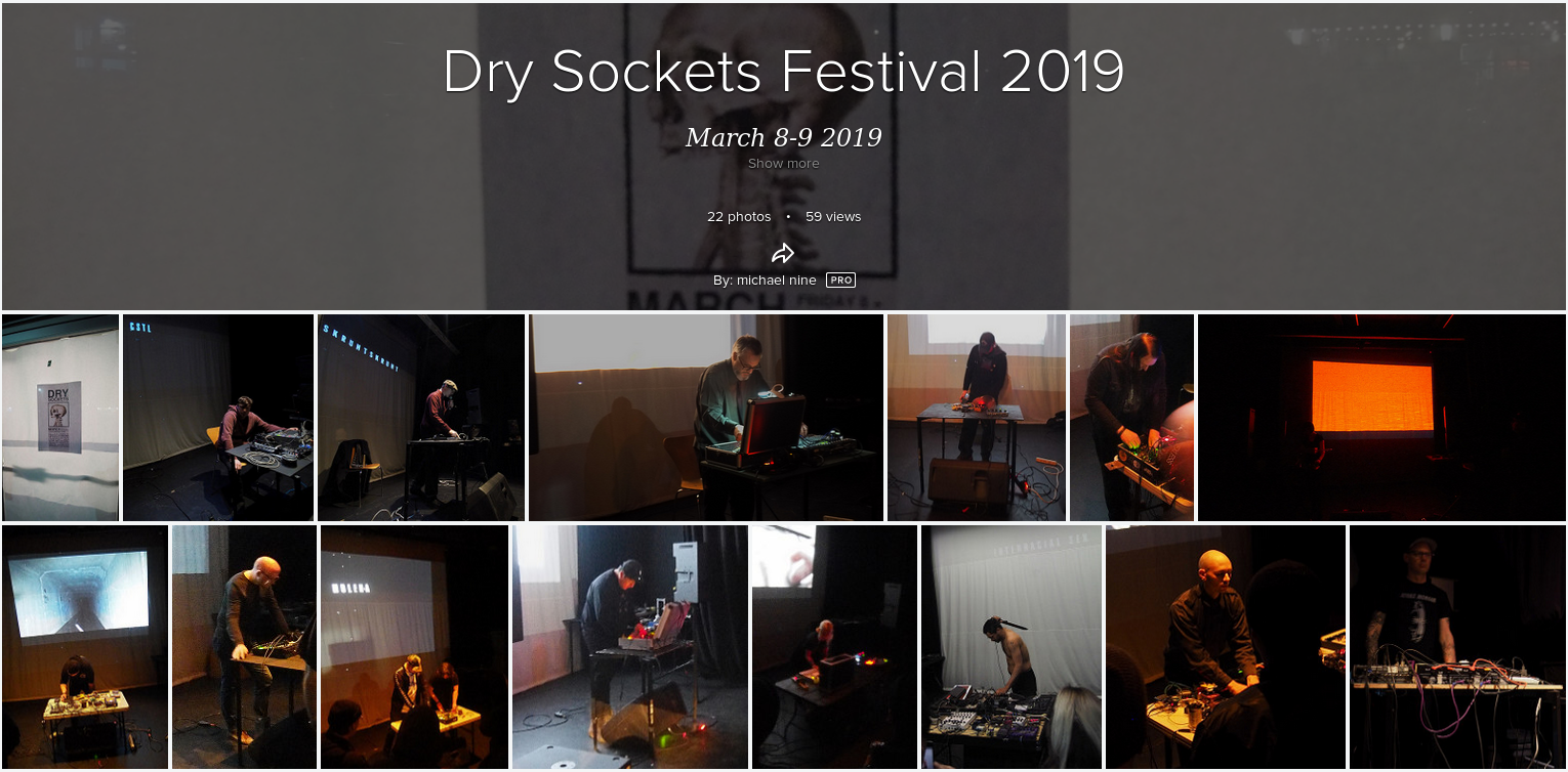 Dry Sockets Flickr Set By Michael Nine